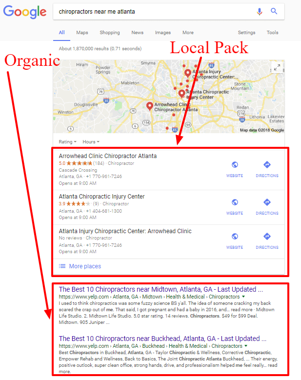 Local SEO Packages local Pack & Organic Results